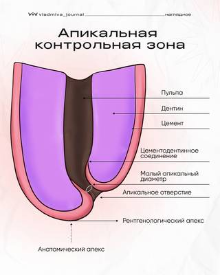 Апикальный контроль: визуализация каждого миллиметра.